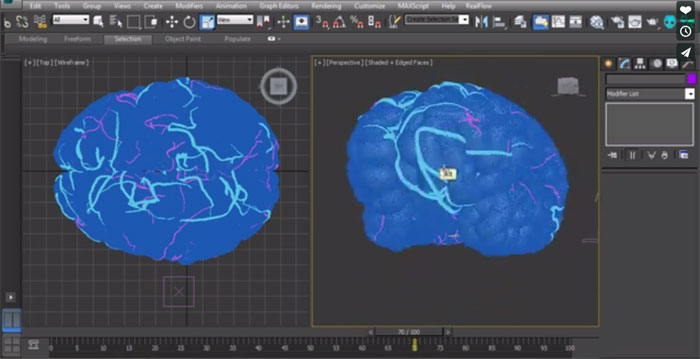 How to apply particle flow in 3ds max for generating realistic brain veins